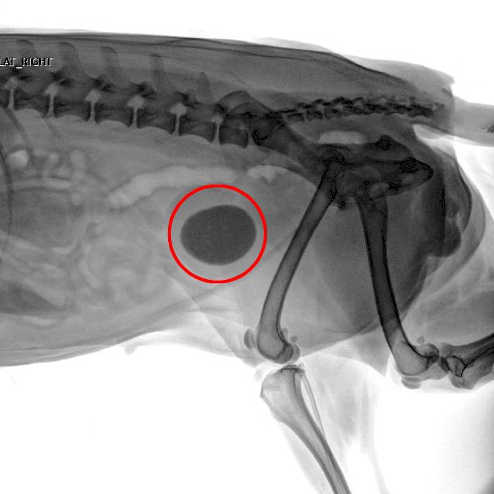 นิ่วก้อนใหญ่ของลาเต้